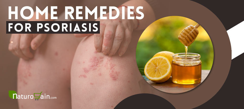 Natural Home Remedies for Psoriasis