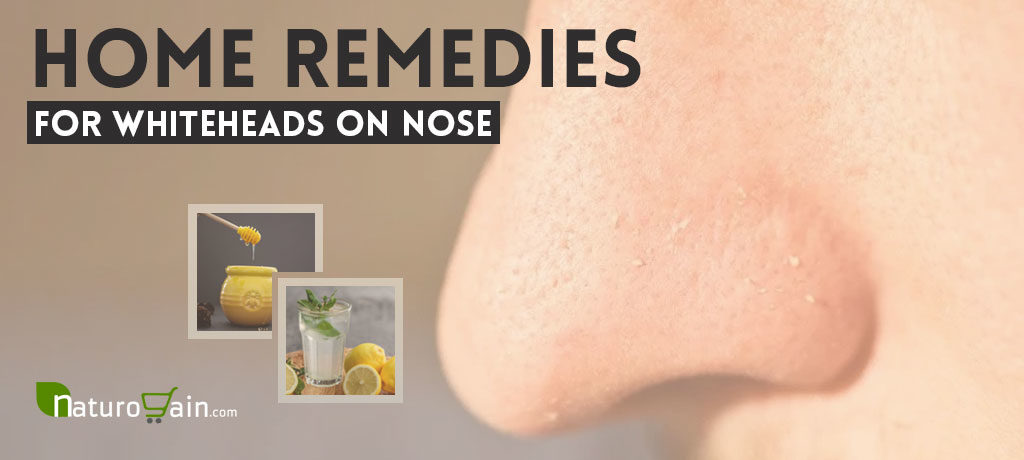 Home Remedies for Whiteheads