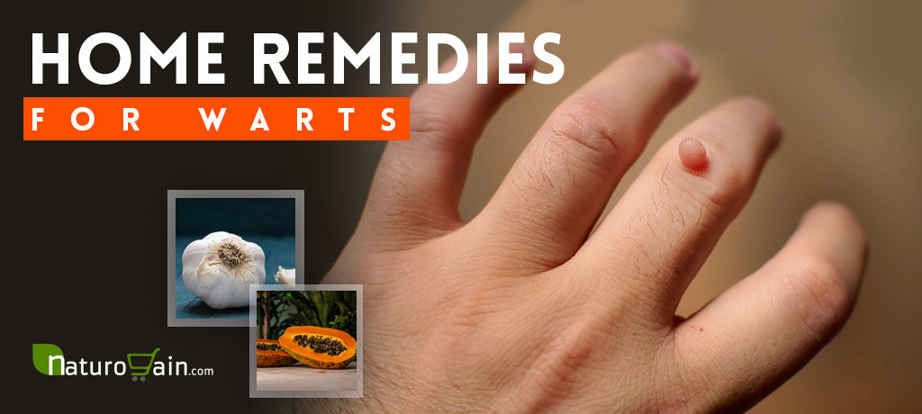 Home Remedies for Warts