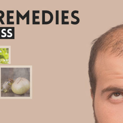 herbal-remedies-for-baldness