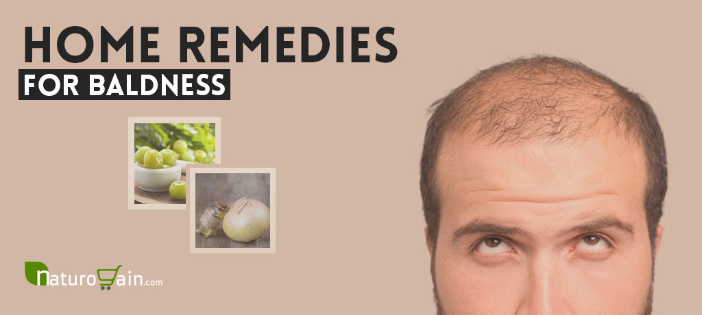 Best Home Remedies for Baldness