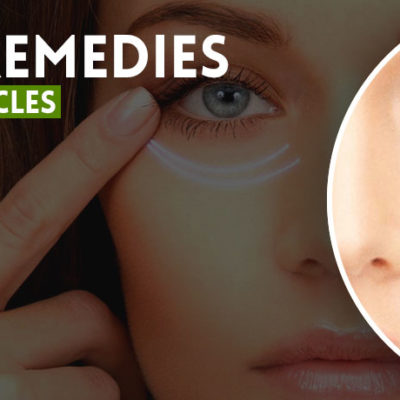 home-remedies-for-dark-circles
