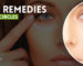 Best Home Remedies for Dark Circles