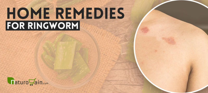 8 DIY Home Remedies for Ringworm Treatment that Work