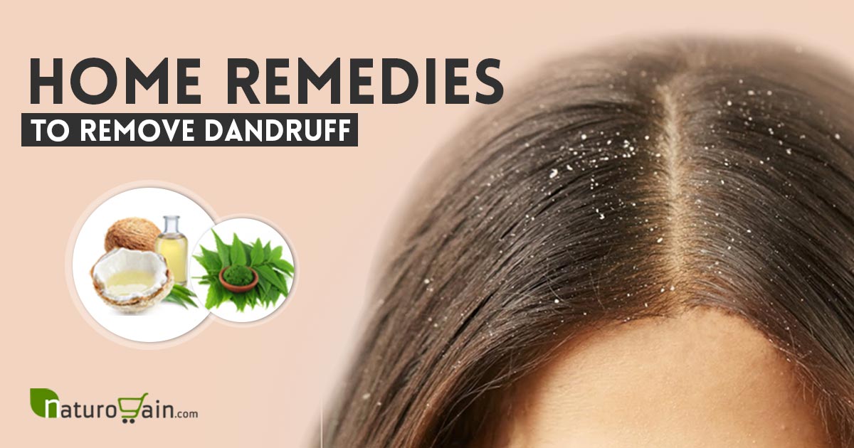 10 Best Home Remedies to Remove Dandruff Fast (Naturally)
