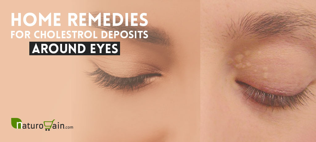 10 Natural Home Remedies for Cholesterol Deposits Around Eyes