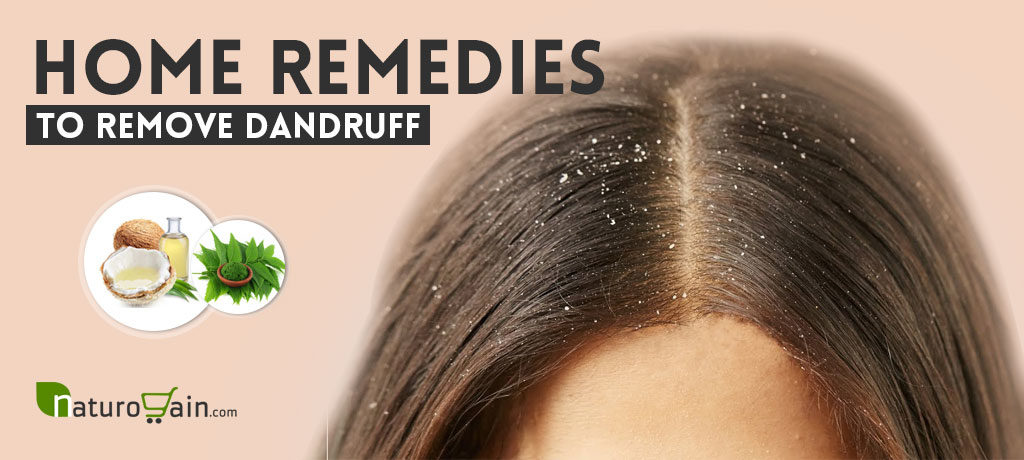 Home Remedies to Remove Dandruff