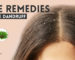 Home Remedies to Remove Dandruff