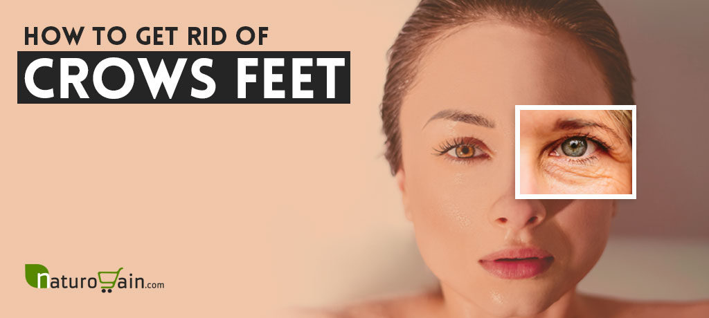 How to Get Rid of Crow's Feet