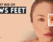 How to Get Rid of Crow's Feet