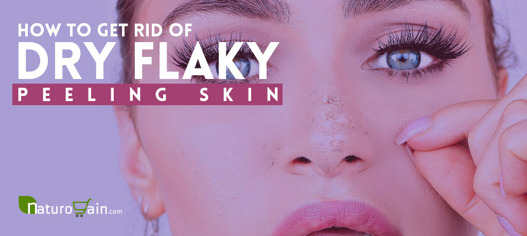 Get Rid of Dry Flaky Peeling Skin