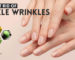 How to Get Rid of Knuckle Wrinkles