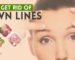 Get Rid of Frown Lines or Glabellar Lines