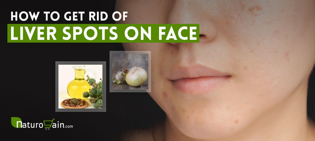 Get Rid of Liver Spots on Your Face