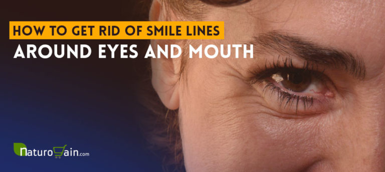 how to get rid of smile lines under your eyes