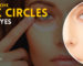 Remove Dark Circles Under Eyes Fast