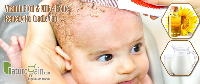 Home Remedy for Cradle Cap