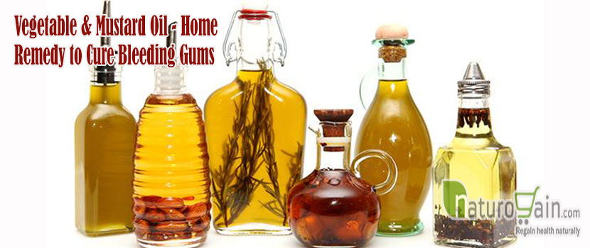 Home Remedy to Cure Bleeding Gums