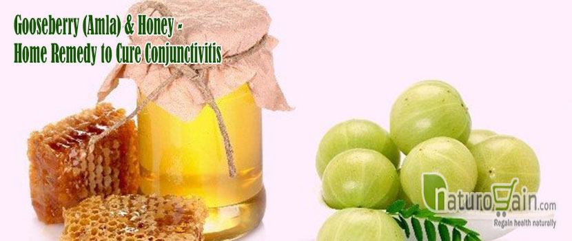 Home Remedy to Cure Conjunctivitis