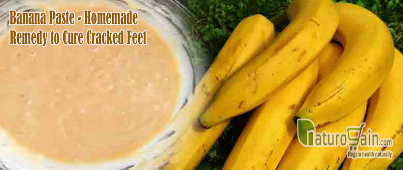 Homemade Remedy to Cure Cracked Feet