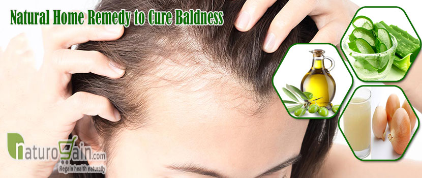 Natural Home Remedy to Cure Baldness