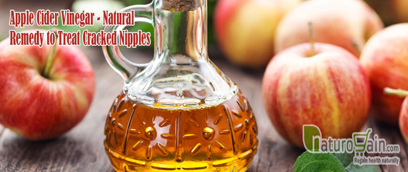 Natural Remedy to Treat Cracked Nipples