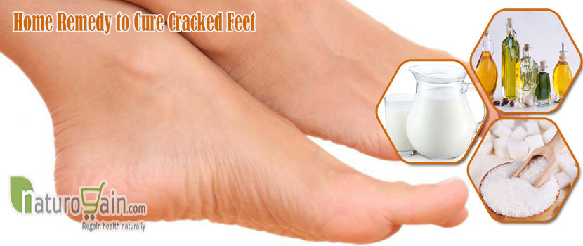 Home Remedy to Cure Cracked Feet