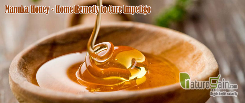 Home Remedy to Cure Impetigo