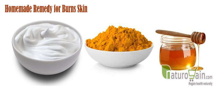 Homemade Remedy for Burns Skin