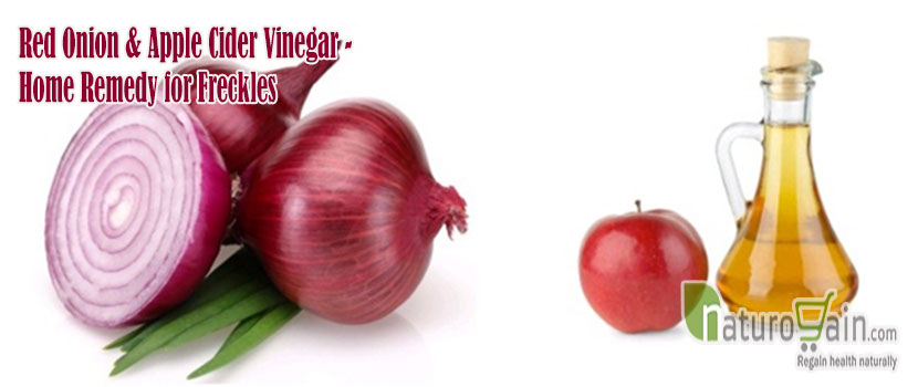 Red Onion and Apple Cider Vinegar