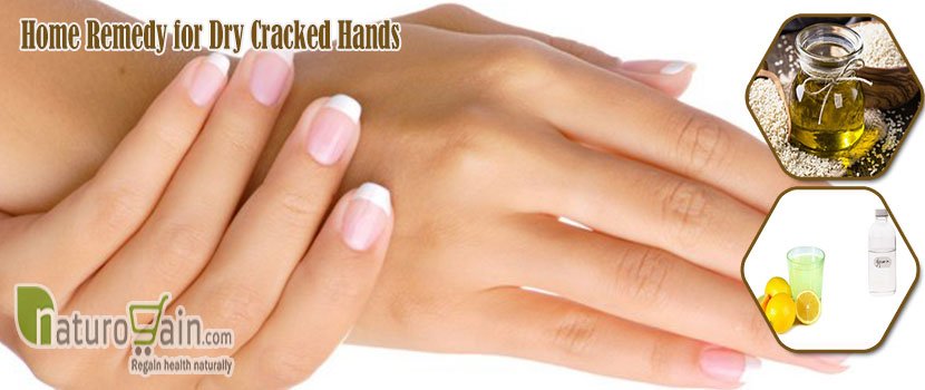 Remedy for Dry Cracked Hands