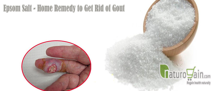 Remedy to Get Rid of Gout