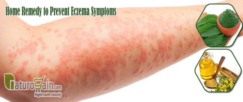 Remedy to Prevent Eczema Symptoms