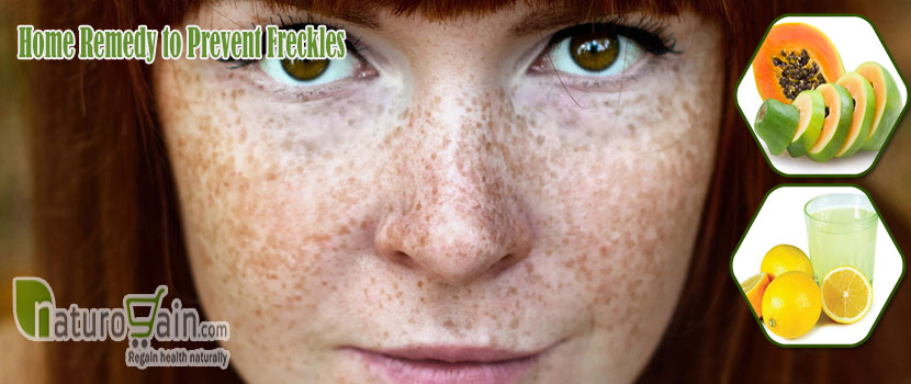 Remedy to Prevent Freckles