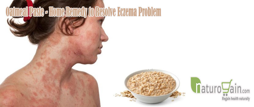 Remedy to Resolve Eczema-problem