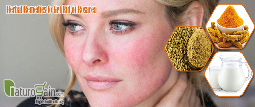 Remedies to Get Rid of Rosacea