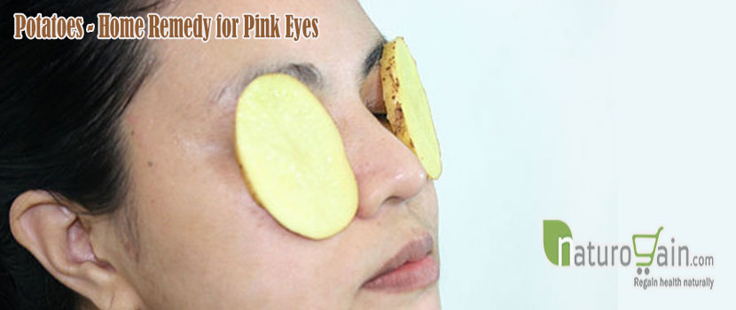 Remedy for Pink Eyes