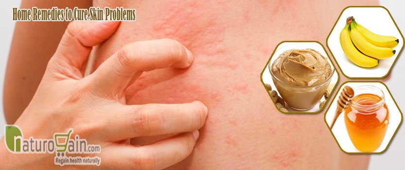 Home Remedies to Cure Skin Problems