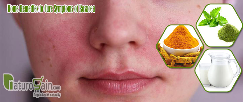 Home Remedies to Cure Symptoms of Rosacea