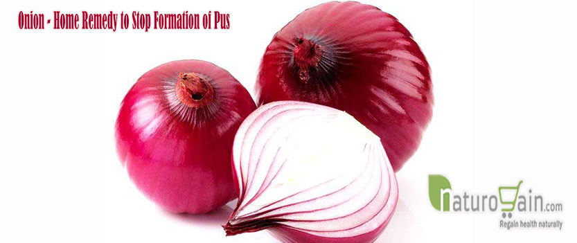 Onion