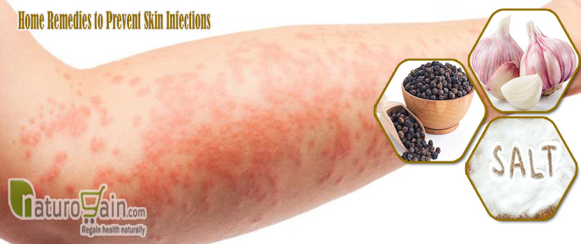 Skin Infections