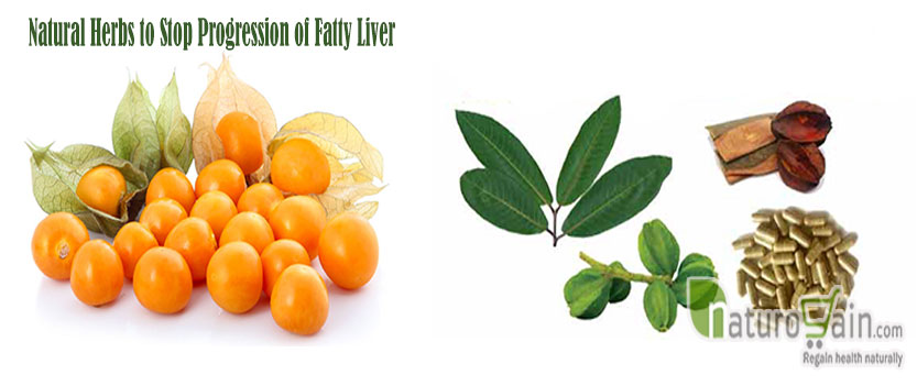 Herbs to Stop Progression of Fatty Liver