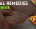 Herbal Remedies for Gout