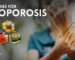 Home Remedies for Osteoporosis