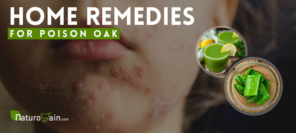 Home Remedies for Poison Oak