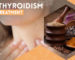 Hyperthyroidism Natural Treatment