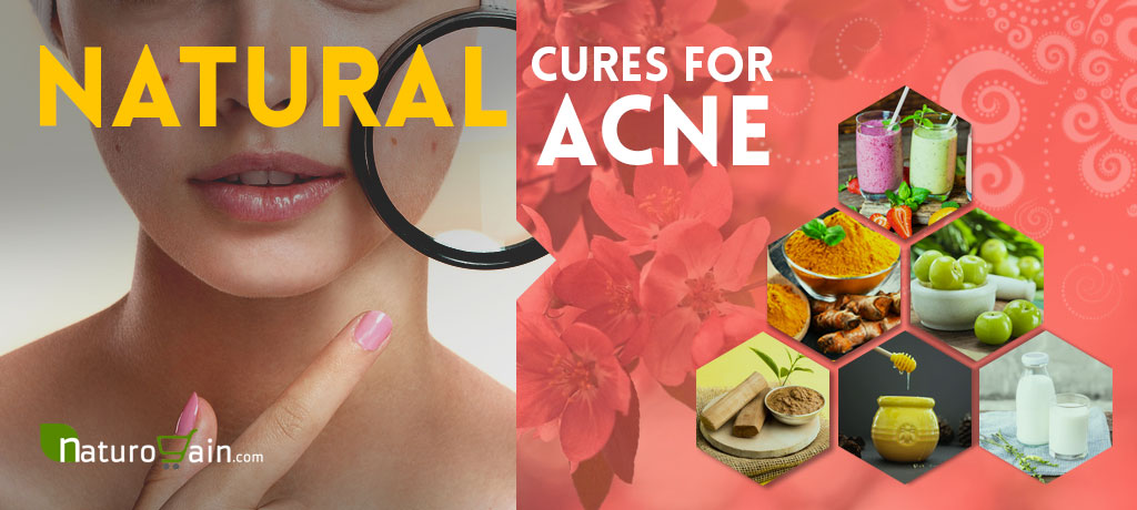 Natural Acne Cures