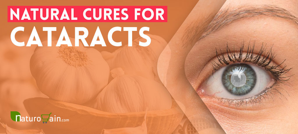 Natural Cures for Cataracts