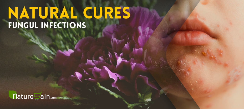 Natural Cures for Fungal Infections