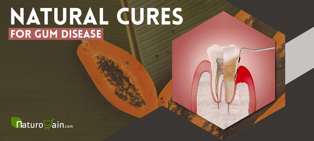 Natural Cures for Gum Disease